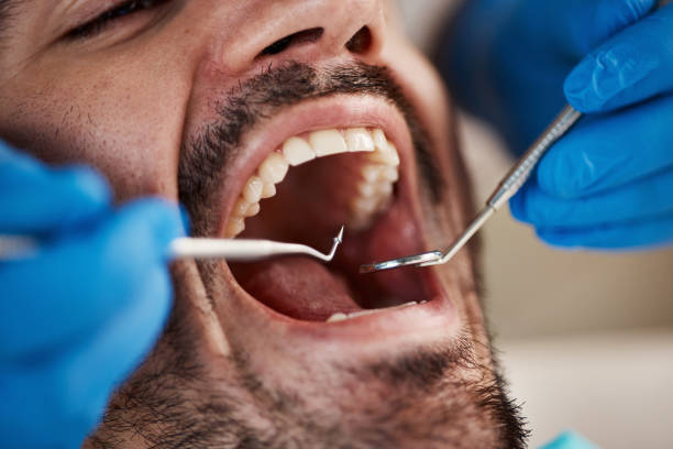 Best Dentist for Tooth Abscess  in Hoschton, GA